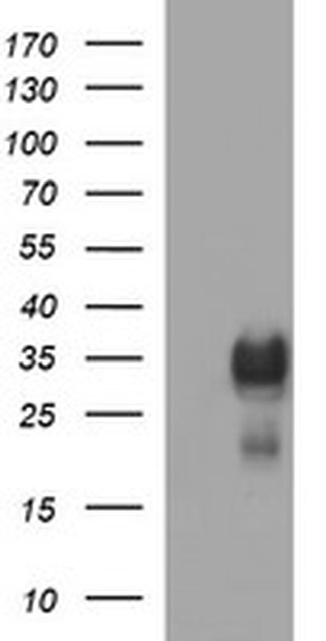 TMX1 Antibody in Western Blot (WB)