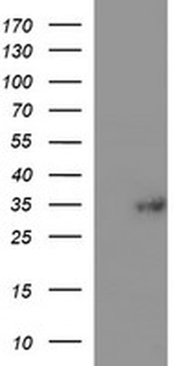 TMX1 Antibody in Western Blot (WB)