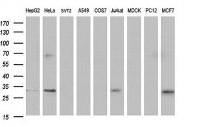 TMX1 Antibody in Western Blot (WB)