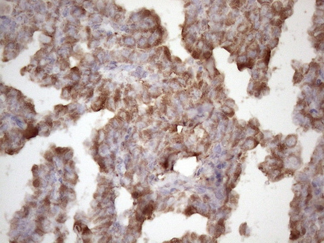 TNFA Antibody in Immunohistochemistry (Paraffin) (IHC (P))