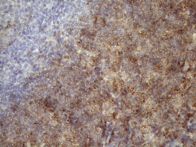 TNFA Antibody in Immunohistochemistry (Paraffin) (IHC (P))