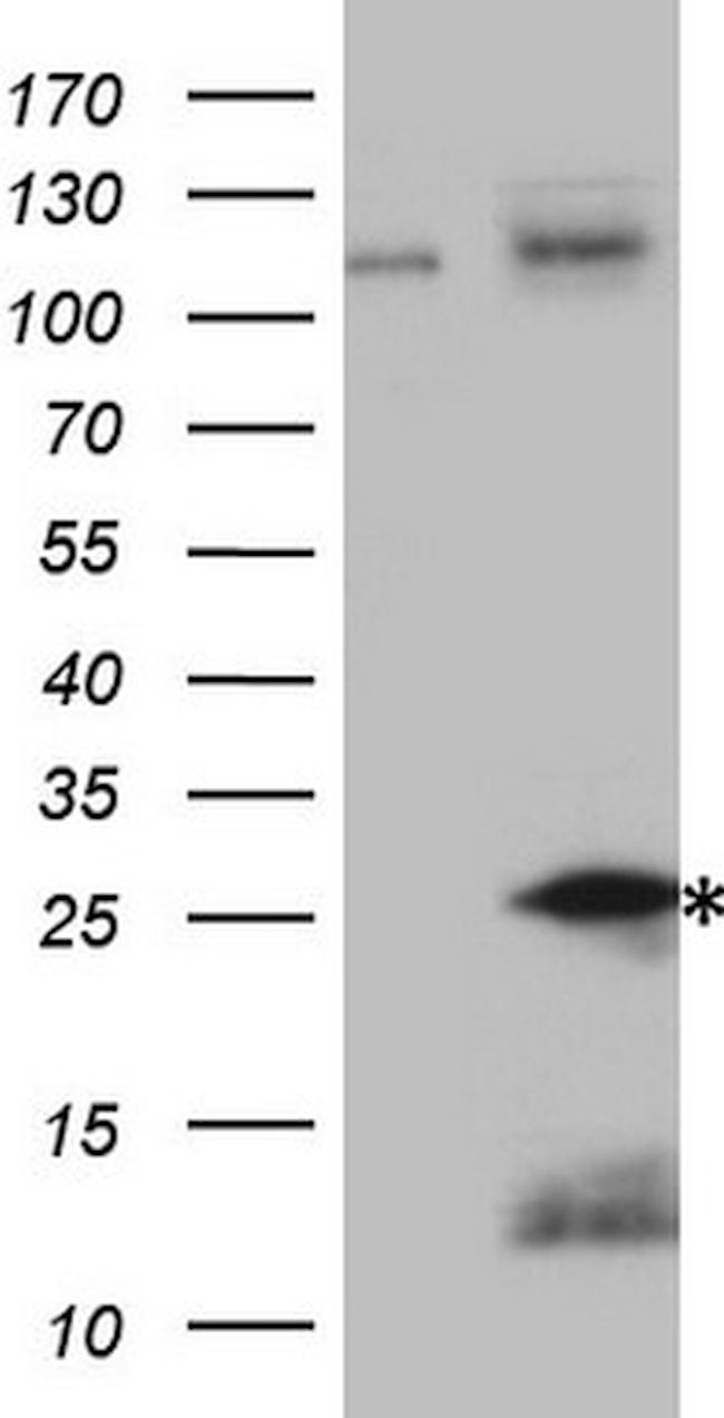 TNFA Antibody in Western Blot (WB)