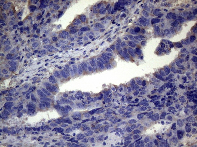 TNFRSF10B Antibody in Immunohistochemistry (Paraffin) (IHC (P))