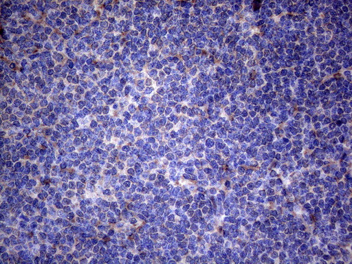 TNFRSF10B Antibody in Immunohistochemistry (Paraffin) (IHC (P))