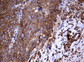 TNFRSF8 Antibody in Immunohistochemistry (Paraffin) (IHC (P))