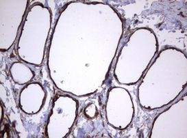 TNFRSF8 Antibody in Immunohistochemistry (Paraffin) (IHC (P))