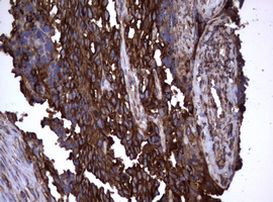 TNFRSF8 Antibody in Immunohistochemistry (Paraffin) (IHC (P))