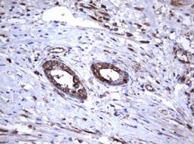 TNFRSF8 Antibody in Immunohistochemistry (Paraffin) (IHC (P))