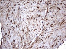 TNFRSF8 Antibody in Immunohistochemistry (Paraffin) (IHC (P))