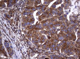 TNFRSF8 Antibody in Immunohistochemistry (Paraffin) (IHC (P))