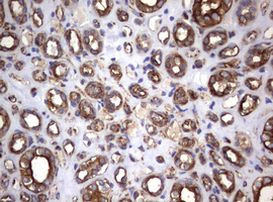 TNFRSF8 Antibody in Immunohistochemistry (Paraffin) (IHC (P))