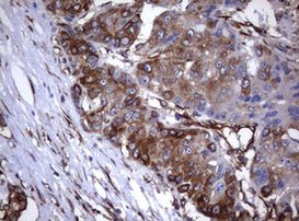 TNFRSF8 Antibody in Immunohistochemistry (Paraffin) (IHC (P))