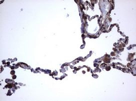 TNFRSF8 Antibody in Immunohistochemistry (Paraffin) (IHC (P))