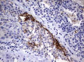 TNFRSF8 Antibody in Immunohistochemistry (Paraffin) (IHC (P))