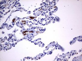 TNFRSF8 Antibody in Immunohistochemistry (Paraffin) (IHC (P))