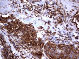 TNFRSF8 Antibody in Immunohistochemistry (Paraffin) (IHC (P))