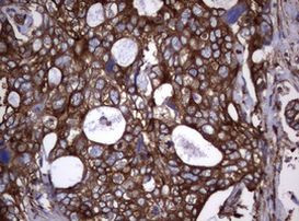 TNFRSF8 Antibody in Immunohistochemistry (Paraffin) (IHC (P))