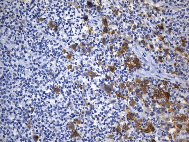 TNFRSF8 Antibody in Immunohistochemistry (Paraffin) (IHC (P))