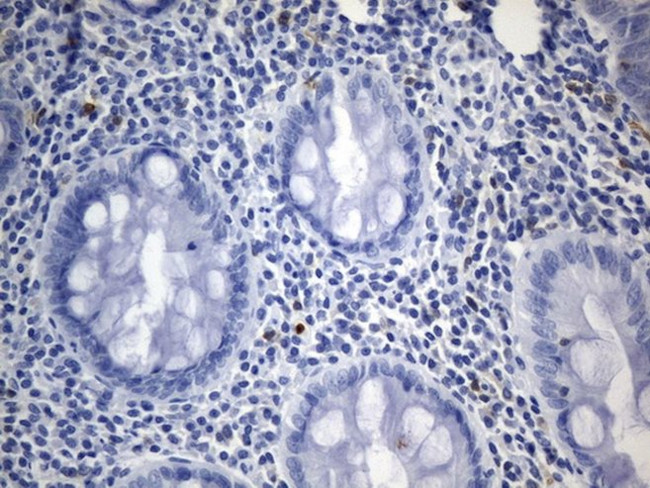 TNFRSF8 Antibody in Immunohistochemistry (Paraffin) (IHC (P))