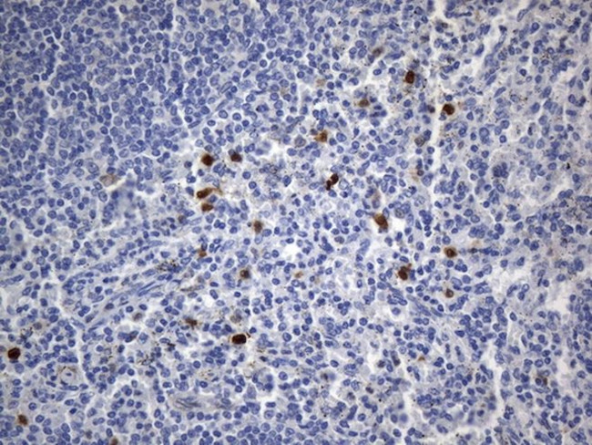 TNFRSF8 Antibody in Immunohistochemistry (Paraffin) (IHC (P))