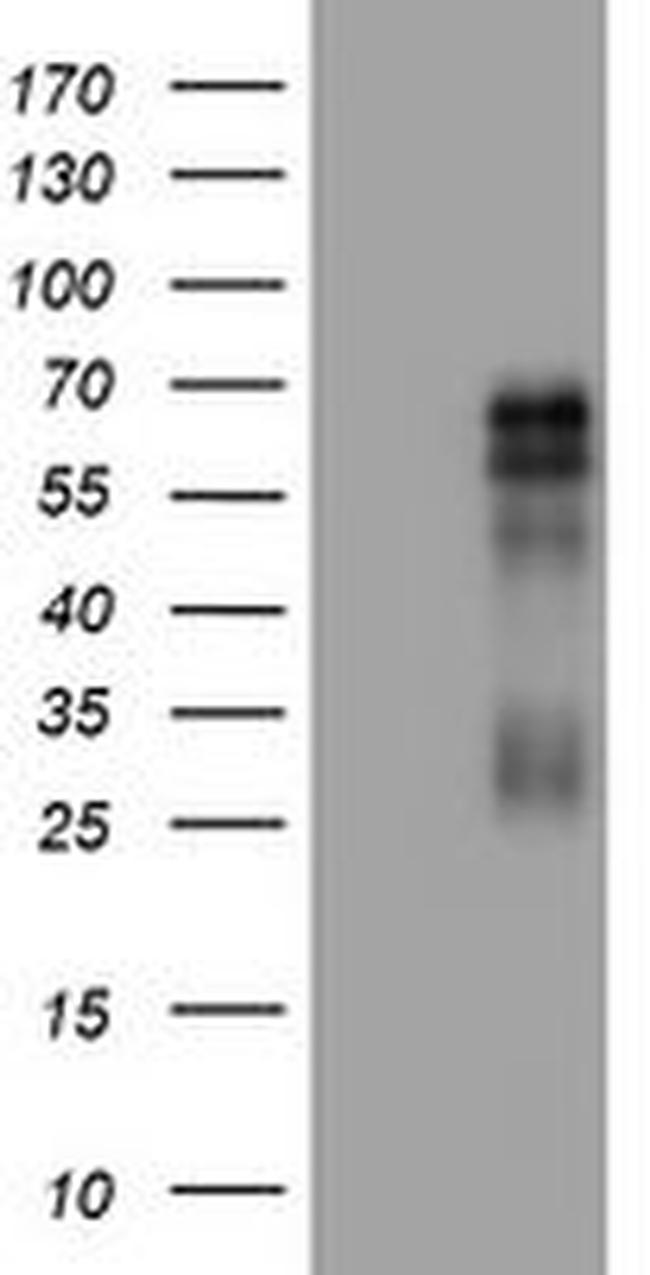 TNFRSF8 Antibody in Western Blot (WB)