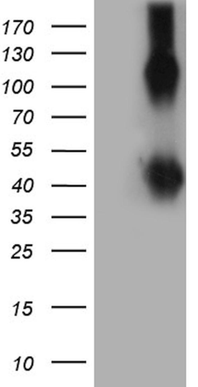 TNFRSF8 Antibody in Western Blot (WB)