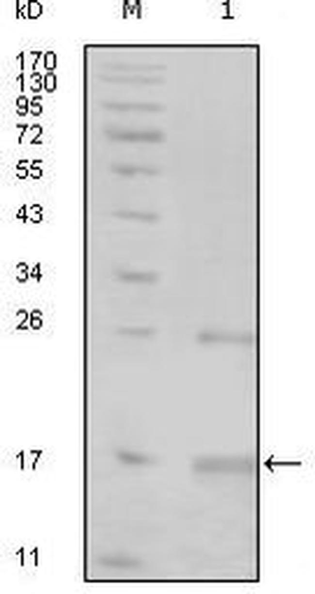 TNK1 Antibody in Western Blot (WB)