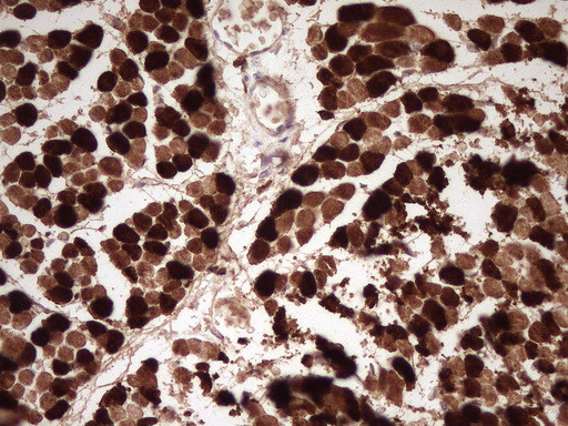 TNNI2 Antibody in Immunohistochemistry (Paraffin) (IHC (P))