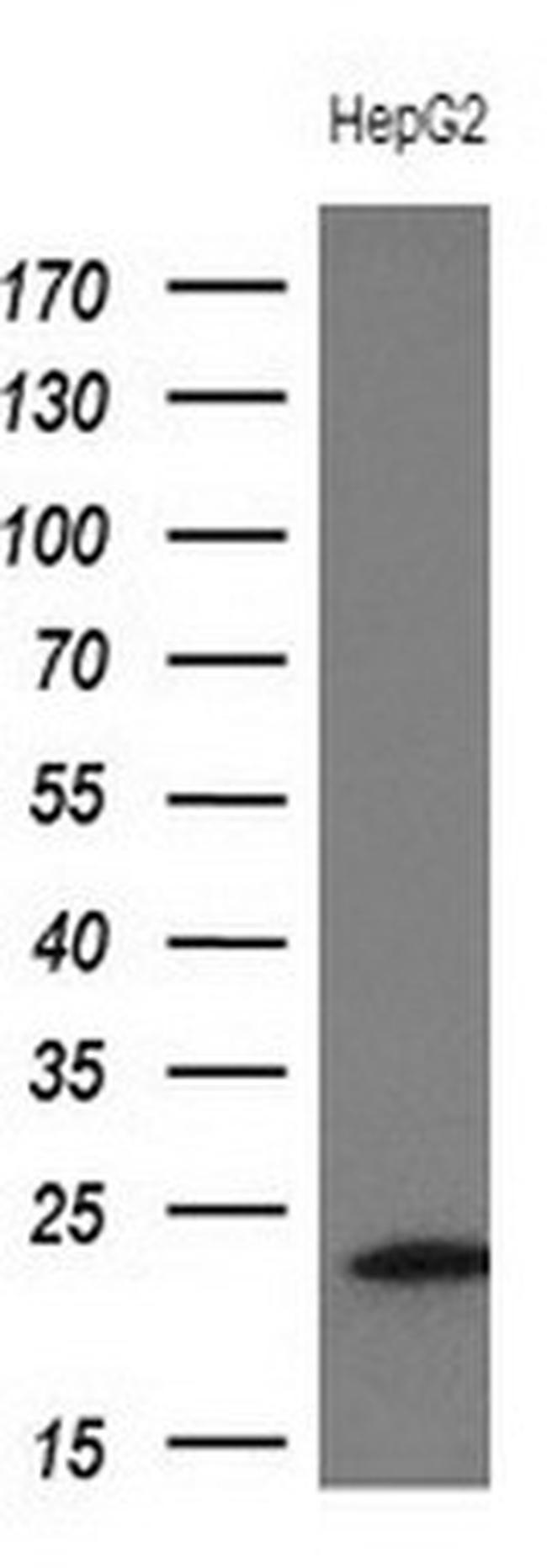 TNNI2 Antibody in Western Blot (WB)