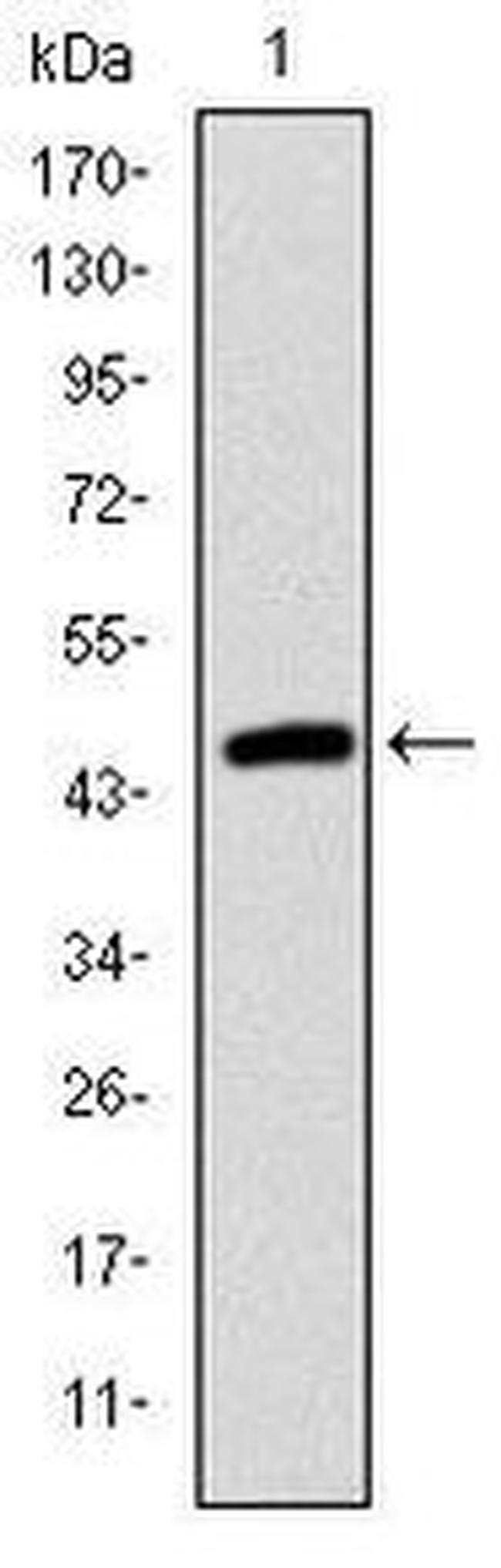 TNNI2 Antibody in Western Blot (WB)