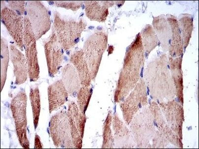 TNNI2 Antibody in Immunohistochemistry (Paraffin) (IHC (P))