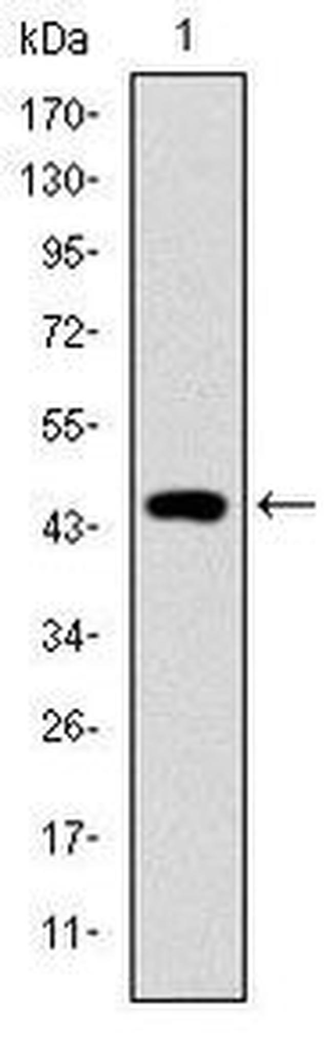 TNNI2 Antibody in Western Blot (WB)