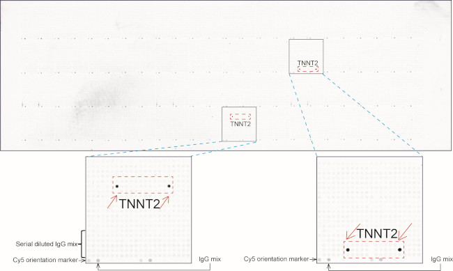 TNNT2 Antibody in Peptide array (ARRAY)