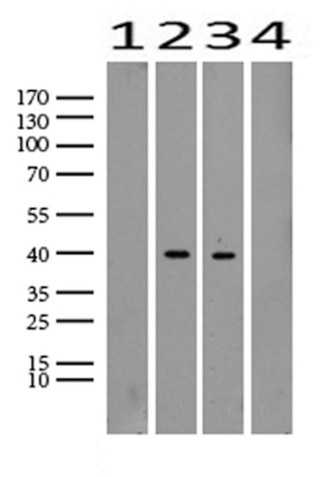 TNNT2 Antibody in Western Blot (WB)