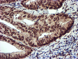 TOMM34 Antibody in Immunohistochemistry (Paraffin) (IHC (P))