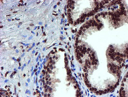 TOMM34 Antibody in Immunohistochemistry (Paraffin) (IHC (P))