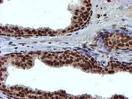 TOMM34 Antibody in Immunohistochemistry (Paraffin) (IHC (P))