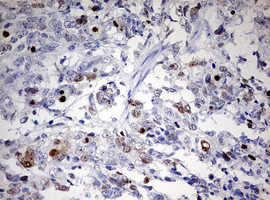 TOP2A Antibody in Immunohistochemistry (Paraffin) (IHC (P))