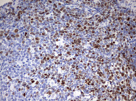 TOP2A Antibody in Immunohistochemistry (Paraffin) (IHC (P))