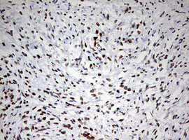 TOP2A Antibody in Immunohistochemistry (Paraffin) (IHC (P))