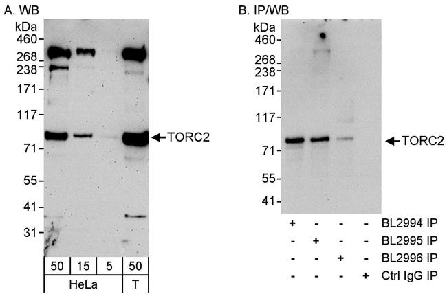 TORC2 Antibody in Western Blot (WB)