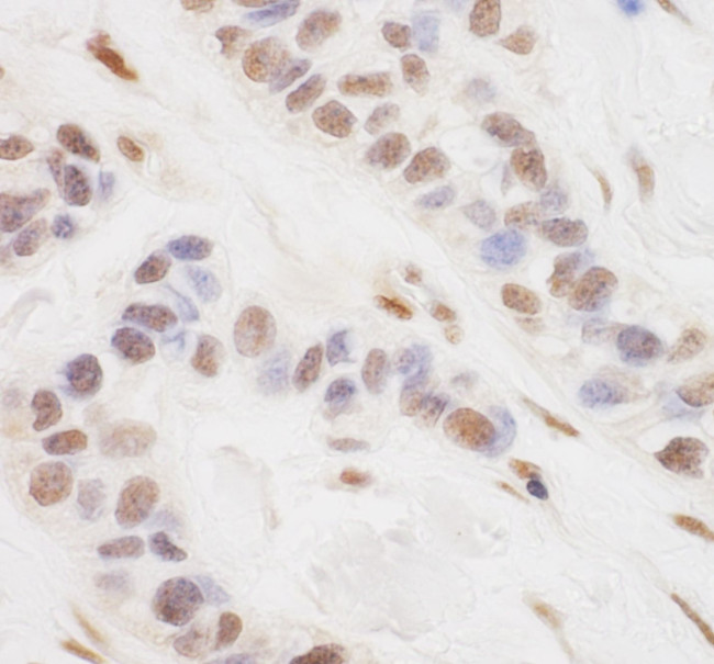 TORC3 Antibody in Immunohistochemistry (IHC)