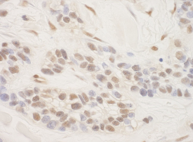 TORC3 Antibody in Immunohistochemistry (IHC)