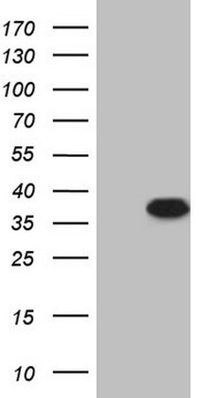 TP53RK Antibody in Western Blot (WB)