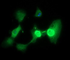 TP73 Antibody in Immunocytochemistry (ICC/IF)