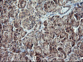 TP73 Antibody in Immunohistochemistry (Paraffin) (IHC (P))