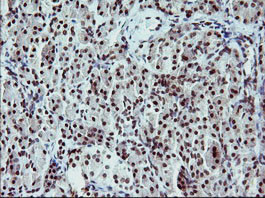 TP73 Antibody in Immunohistochemistry (Paraffin) (IHC (P))