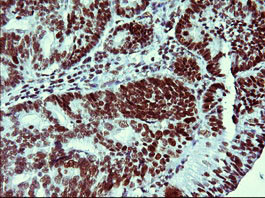 TP73 Antibody in Immunohistochemistry (Paraffin) (IHC (P))