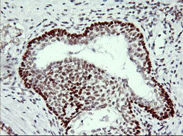 TP73 Antibody in Immunohistochemistry (Paraffin) (IHC (P))