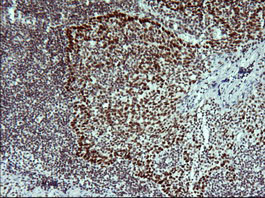 TP73 Antibody in Immunohistochemistry (Paraffin) (IHC (P))